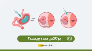 عکس بوتاکس معده