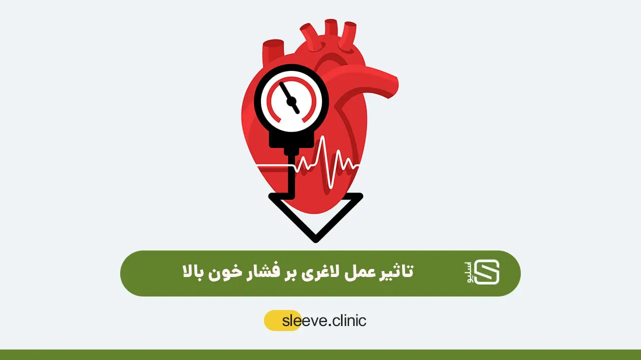 درمان فشار خون بالا با عمل لاغری شاخص