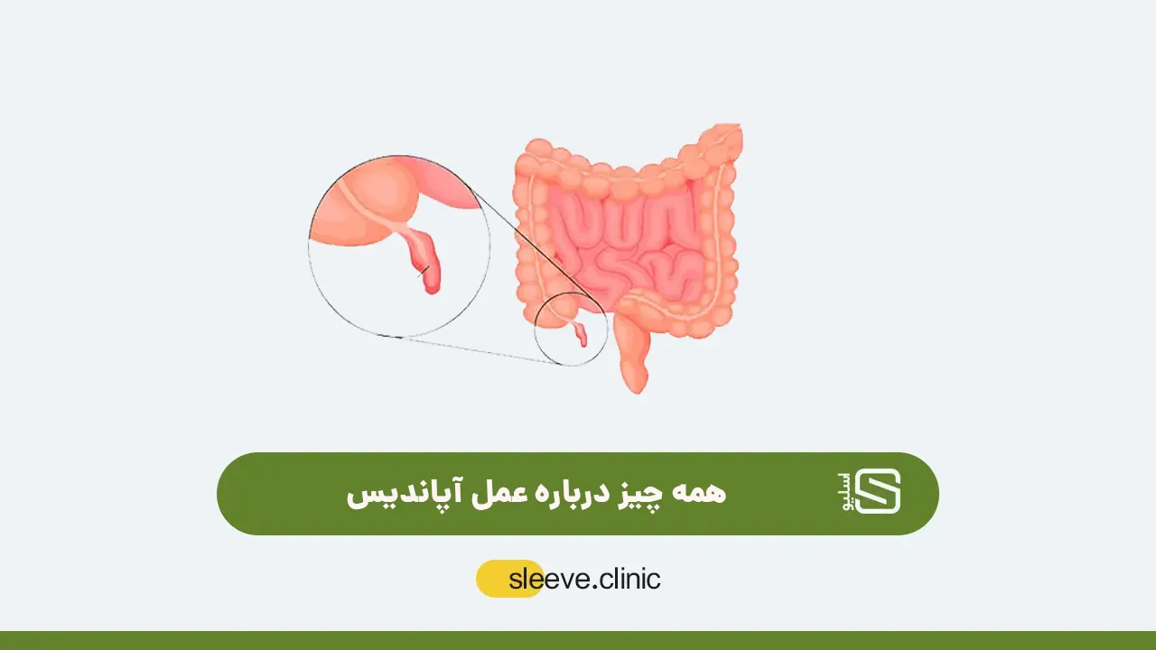 عمل لاپاراسکوپی شاخص