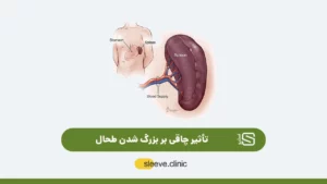 تأثیر چاقی بر بزرگ شدن طحال شاخص