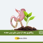 دوره نقاهت بعد از عمل مینی بای پس شاخص