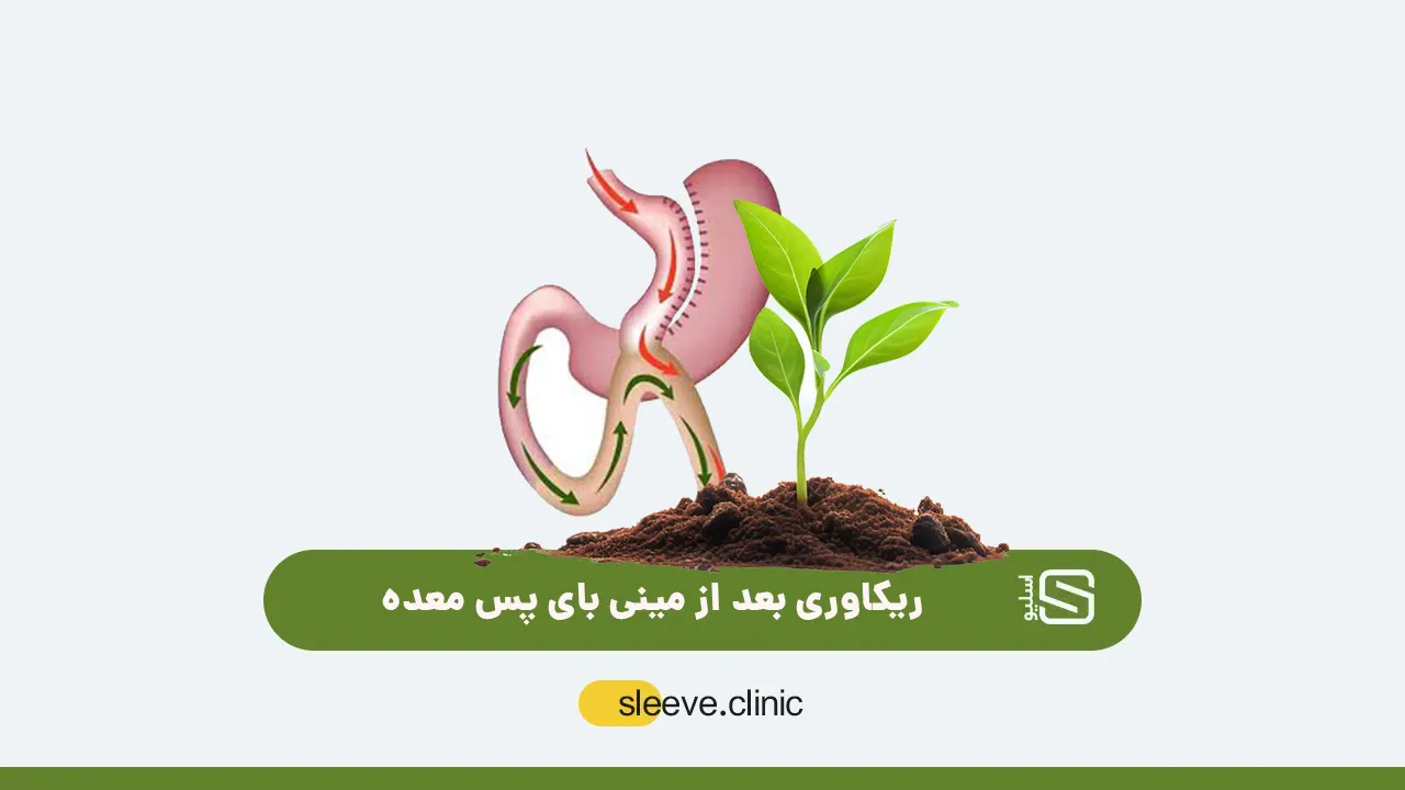 دوره نقاهت بعد از عمل مینی بای پس شاخص