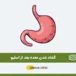 راهنمای فعالیت و ورزش بعد از عمل لاغری (توضیحات کلی)